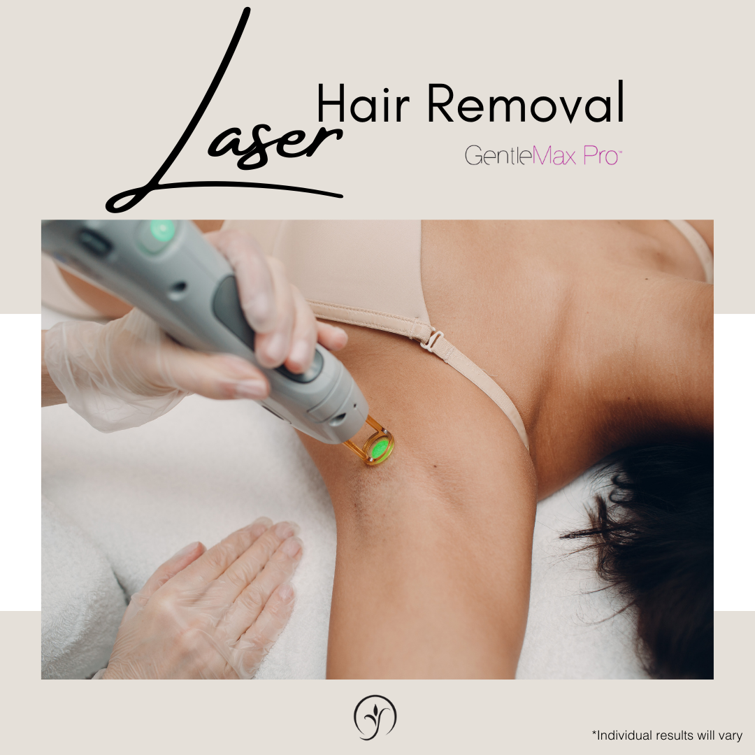 gmax laser hair removal